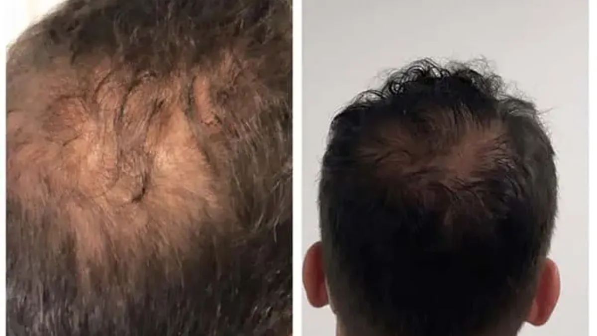 Antes e depois — paciente 2