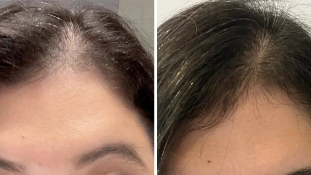 Antes e depois — paciente 3