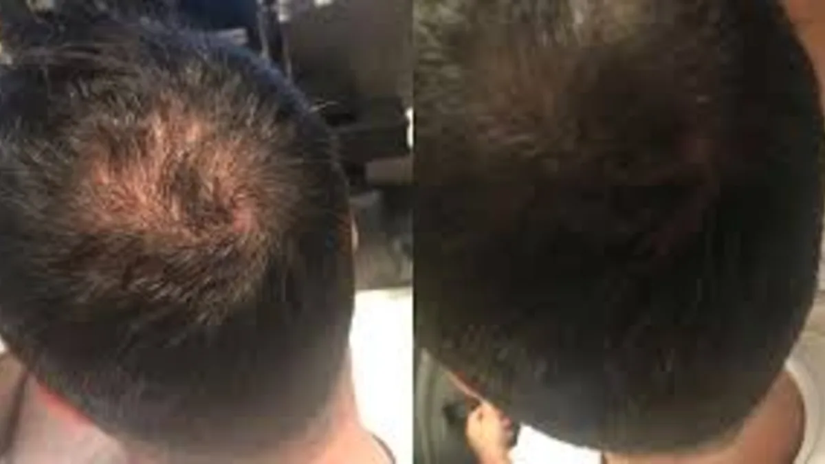 Antes e depois — paciente 4